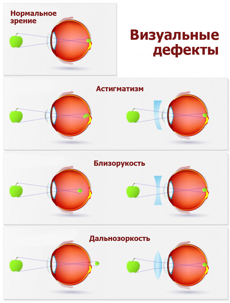 Лечение зрения глаз курск